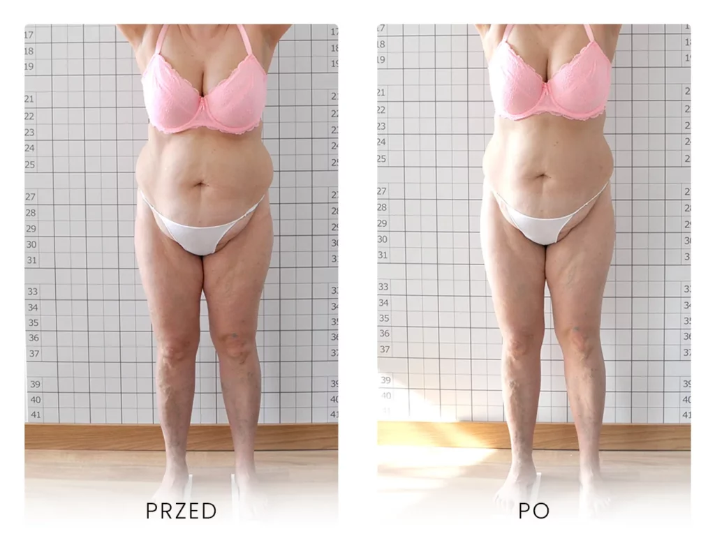 Icoone - Efekty z przodu