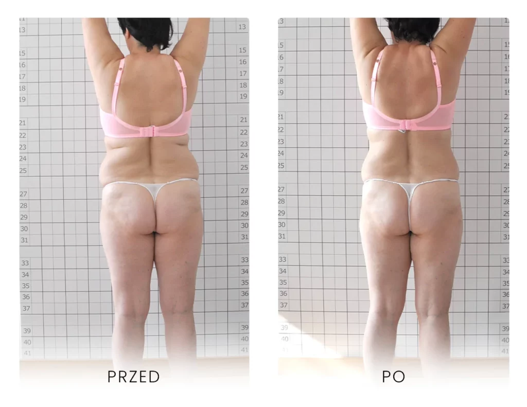 Icoone - Efekty z tyłu